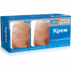 Крем До и после антицеллюлитный 100 мл
